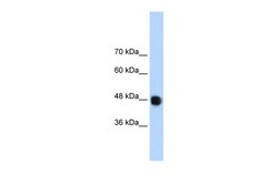 Aviva Systems Biology Corp DAZAP1 Antibody - C-terminal region (ARP40927_T100)