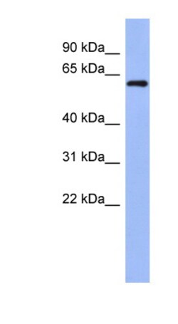 Aviva Systems Biology Corp RBM47 Antibody - middle region (ARP40932_P050)