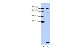 Aviva Systems Biology Corp LSM2 Antibody - middle region (ARP40963_T100)