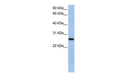Aviva Systems Biology Corp EIF4H Antibody - C-terminal region (ARP40977_P050)