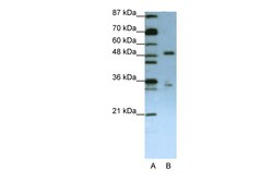 Aviva Systems Biology Corp UPF3B Antibody - N-terminal region (ARP40998_T100)