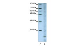 Aviva Systems Biology Corp FAM121B Antibody - N-terminal region (ARP41007_T100)
