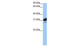 Aviva Systems Biology Corp MRPL24 Antibody - N-terminal region (ARP41010_P050)