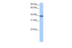 Aviva Systems Biology Corp MRM1 Antibody - C-terminal region (ARP41014_P050)