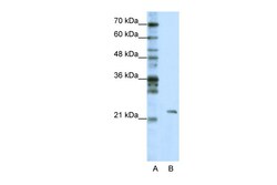 Aviva Systems Biology Corp MRM1 Antibody - C-terminal region (ARP41015_T100)
