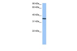 Aviva Systems Biology Corp HNRNPA2B1 Antibody - N-terminal region (ARP41035_P050)