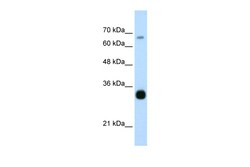 Aviva Systems Biology Corp THOC3 Antibody - middle region (ARP41052_T100)
