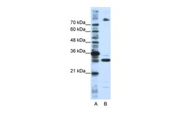 Aviva Systems Biology Corp SRSF10 Antibody - C-terminal region (ARP41082_P050)