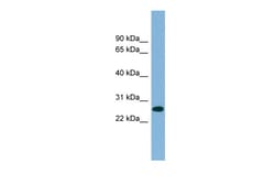 Aviva Systems Biology Corp SRrp35 Antibody - middle region (ARP41089_P050)