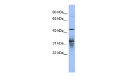 Aviva Systems Biology Corp PABPC5 Antibody - N-terminal region (ARP41090_P050)
