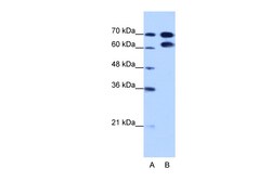 Aviva Systems Biology Corp RAVER1 Antibody - N-terminal region (ARP41099_T100)