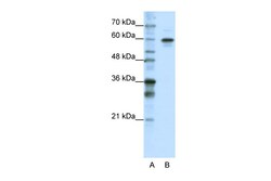 Aviva Systems Biology Corp HNRPLL Antibody - N-terminal region (ARP41102_T100)