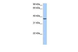 Aviva Systems Biology Corp ALKBH8 Antibody - N-terminal region (ARP41106_P050)