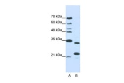 Aviva Systems Biology Corp ALKBH8 Antibody - N-terminal region (ARP41107_T100)