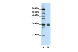 Aviva Systems Biology Corp MSI2 Antibody - N-terminal region (ARP41112_T100)