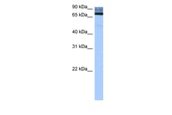 Aviva Systems Biology Corp ADAD2 Antibody - middle region (ARP41114_P050)