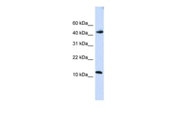 Aviva Systems Biology Corp APOBEC3F Antibody - C-terminal region (ARP41136_P050)