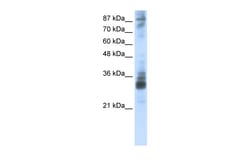 Aviva Systems Biology Corp RG9MTD2 Antibody - middle region (ARP41144_T100)