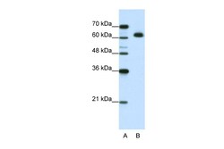 Aviva Systems Biology Corp MGC42174 Antibody - N-terminal region (ARP41145_T100)