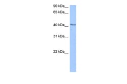 Aviva Systems Biology Corp DCP2 Antibody - C-terminal region (ARP41150_P050)