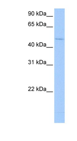 Aviva Systems Biology Corp RBM45 Antibody - middle region (ARP41154_P050)