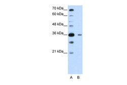 Aviva Systems Biology Corp DAZAP1 Antibody - C-terminal region (ARP41161_P050)