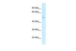 Aviva Systems Biology Corp Uhmk1 Antibody - C-terminal region (ARP41180_P050)