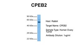 Aviva Systems Biology Corp CPEB2 Antibody - middle region (ARP41185_P050)