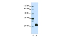 Aviva Systems Biology Corp TMED4 Antibody - N-terminal region (ARP41190_T100)