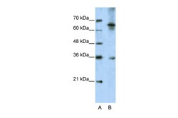 Aviva Systems Biology Corp WNT9B Antibody - C-terminal region (ARP41243_T100)