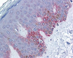 Aviva Systems Biology Corp FZD5 Antibody - middle region (ARP41244_P050)