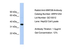 Aviva Systems Biology Corp WNT2B Antibody - middle region (ARP41254_P050)