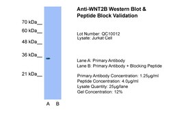 Aviva Systems Biology Corp WNT2B Antibody - middle region (ARP41254_T100)