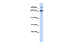 Aviva Systems Biology Corp FZD10 Antibody - N-terminal region (ARP41262_P050)