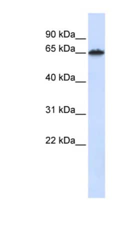 Aviva Systems Biology Corp FZD4 Antibody - middle region (ARP41266_P050)