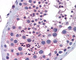 Aviva Systems Biology Corp Wnt10a Antibody - middle region (ARP41277_P050)