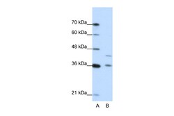 Aviva Systems Biology Corp NKD2 Antibody - N-terminal region (ARP41287_P050)