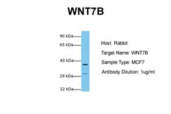 Aviva Systems Biology Corp WNT7B Antibody - middle region (ARP41291_P050)
