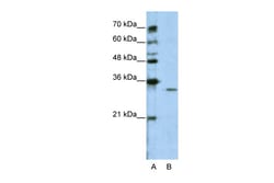 Aviva Systems Biology Corp GNB1L Antibody - C-terminal region (ARP41328_T100)