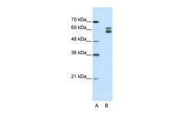 Aviva Systems Biology Corp MSH2 Antibody - N-terminal region (ARP41350_T100)