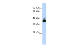 Aviva Systems Biology Corp ALDOB Antibody - middle region (ARP41365_P050)