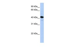 Aviva Systems Biology Corp HSD11B2 Antibody - N-terminal region (ARP41372_P050)