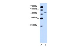 Aviva Systems Biology Corp SLC12A1 Antibody - N-terminal region (ARP41388_P050)