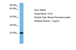 Aviva Systems Biology Corp TNNI3 Antibody - middle region (ARP41391_P050)