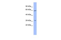 Aviva Systems Biology Corp HRG Antibody - middle region (ARP41396_P050)