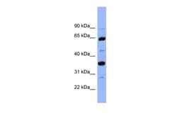 Aviva Systems Biology Corp SERPINC1 Antibody - middle region (ARP41402_P050)