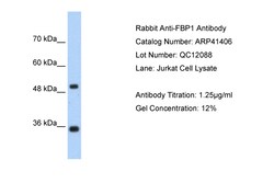 Aviva Systems Biology Corp FBP1 Antibody - N-terminal region (ARP41406_T100)
