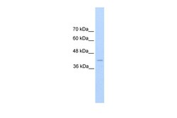 Aviva Systems Biology Corp REN Antibody - C-terminal region (ARP41409_T100)