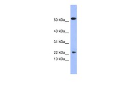 Aviva Systems Biology Corp PLA2G5 Antibody - N-terminal region (ARP41428_P050)