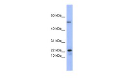 Aviva Systems Biology Corp PLA2G5 Antibody - middle region (ARP41429_P050)